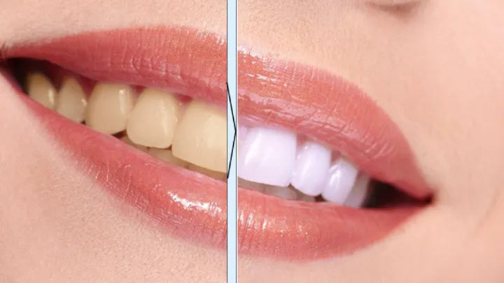 Smart U-Shaped Electric Toothbrush