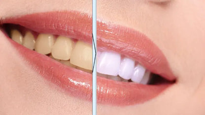 Smart U-Shaped Electric Toothbrush